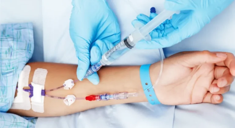 Paciente recibiendo quelación intravenosa en brazo, con suero administrado mediante catéter, manos del médico con guantes azules.