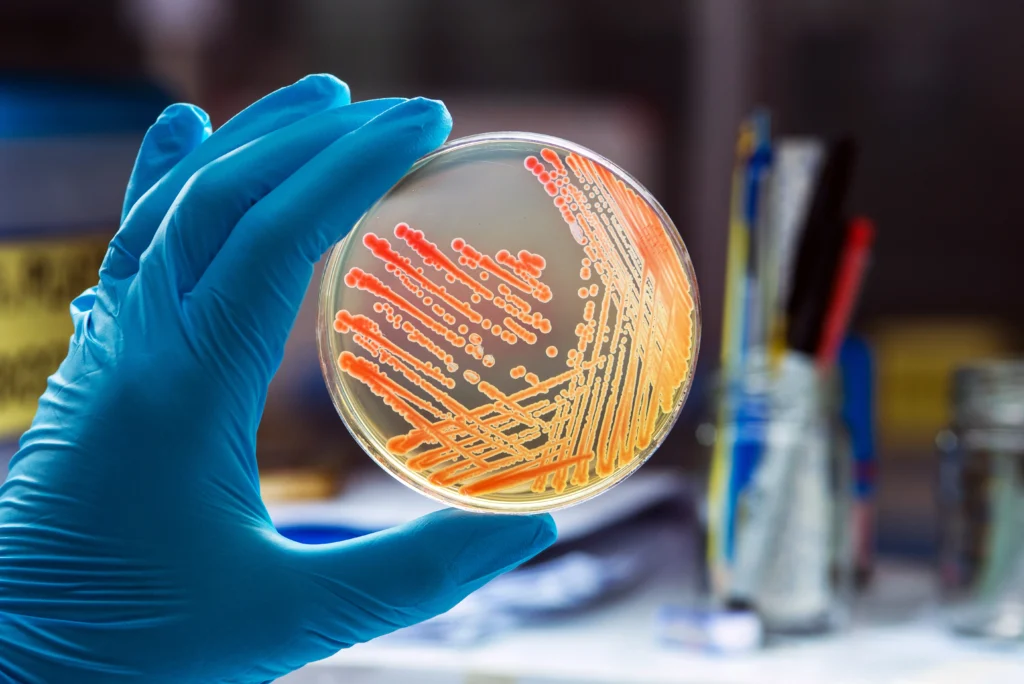 Placa de petri que muestra evidencia de cromosomas de un test epigenético.