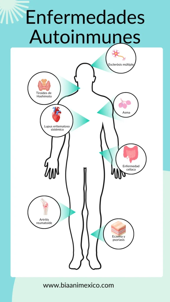 Infografía de persona y sus órganos que son afectados por las enfermedades autoinmunes.